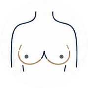 Breast augmentation