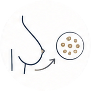 Fat transfer to your breasts